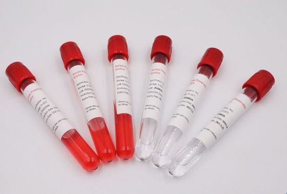 Medical ABS Blood Specimen Tubes Ultra High Impact Resistance